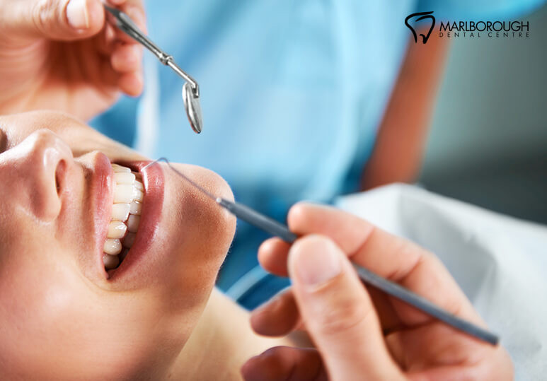 marlborough dental - blog - importance of dental cleaning